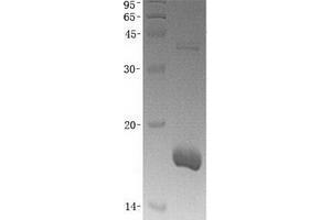 Validation with Western Blot (BCL2L2 Protein)