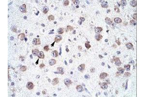 Image no. 1 for anti-RNA-binding protein Raly (RALY) (N-Term) antibody (ABIN6735882) (Raly antibody  (N-Term))