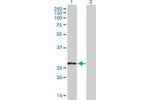 LRRN4CL antibody  (AA 1-238)