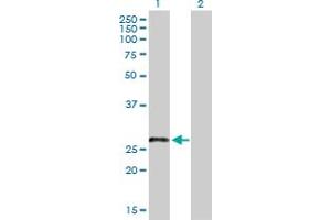 Western Blot analysis of LRRN4CL expression in transfected 293T cell line by LRRN4CL MaxPab polyclonal antibody. (LRRN4CL antibody  (AA 1-238))