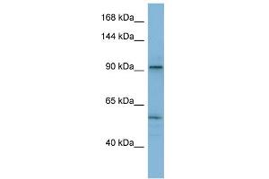 WB Suggested Anti-ATP2A1 Antibody Titration:  0. (ATP2A1/SERCA1 antibody  (N-Term))
