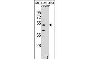 Western blot analysis of WDR51B Antibody Pab pre-incubated without(lane 1) and with(lane 2) blocking peptide in MDA-MB453 cell line lysate. (POC1B antibody  (C-Term))