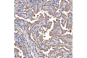 IHC analysis of TTLL2 using anti-TTLL2 antibody (ABIN7600850). (TTLL2 antibody  (AA 24-582))