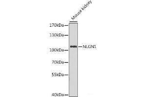 Western blot analysis of extracts of Mouse kidney using NLGN1 Polyclonal Antibody at dilution of 1:1000. (Neuroligin 1 antibody)