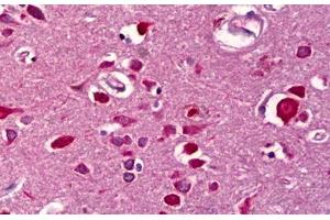 Anti-WISP2 antibody IHC staining of human brain, cortex. (WISP2 antibody)