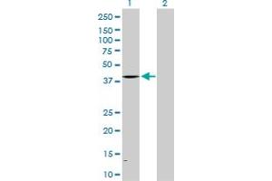 Western Blot analysis of ALAD expression in transfected 293T cell line by ALAD MaxPab polyclonal antibody. (ALAD antibody  (AA 1-339))