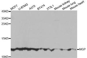 Western blot analysis of extracts of various cell lines, using MGP antibody. (MGP antibody)