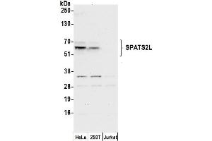 anti-Spermatogenesis Associated, Serine-Rich 2-Like (SPATS2L) (AA 508-558) antibody