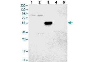 Western blot analysis of Lane 1: RT-4, Lane 2: U-251 MG, Lane 3: Human Plasma, Lane 4: Liver, Lane 5: Tonsil with ANGPT1 polyclonal antibody . (Angiopoietin 1 antibody)