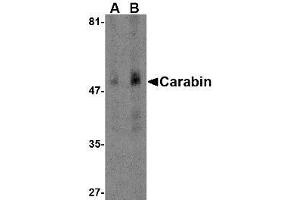 Western blot analysis of Carabin in human spleen tissue lysate with AP30182PU-N Carabin antibody at (A) 1 and (B) 2 μg/ml. (Carabin antibody  (N-Term))