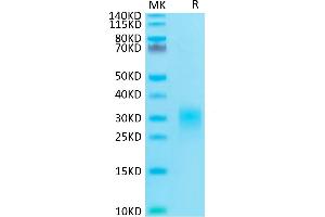 Human Fas Ligand on Tris-Bis PAGE under reduced condition. (FASL Protein (His tag))