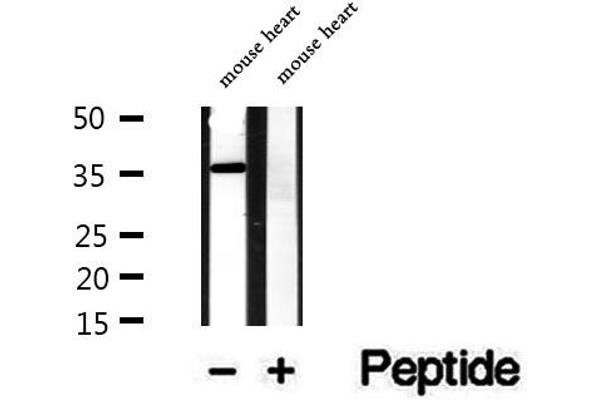 SGCG antibody  (C-Term)