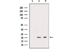 Western blot analysis of extracts from various samples, using Caveolin 1 Antibody. (Caveolin-1 antibody  (C-Term))