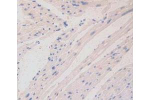 IHC-P analysis of Mouse Heart Tissue, with DAB staining. (LAMa4 antibody  (AA 745-940))