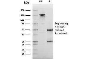 SDS-PAGE Analysis Purified Complement 3d Mouse Monoclonal Antibody (C3D/2891). (Complement 3d (C3d) (Acute Humoral Rejection Marker) antibody)