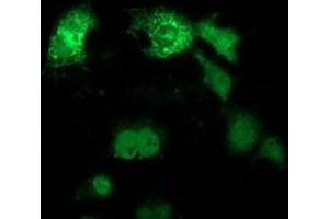Anti-ANKRD53 mouse monoclonal antibody (ABIN2454355) immunofluorescent staining of COS7 cells transiently transfected by pCMV6-ENTRY ANKRD53 (RC206701). (ANKRD53 antibody  (AA 1-300))