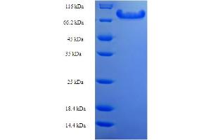 SDS-PAGE (SDS) image for Angiopoietin-Like 2 (ANGPTL2) (AA 23-493) protein (His-SUMO Tag) (ABIN5711949) (ANGPTL2 Protein (AA 23-493) (His-SUMO Tag))