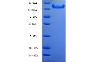SDS-PAGE (SDS) image for Angiopoietin-Like 2 (ANGPTL2) (AA 23-493) protein (His-SUMO Tag) (ABIN4976085)