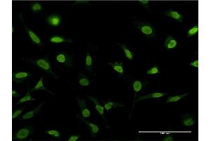Immunofluorescence of monoclonal antibody to PSMA1 on HeLa cell. (PSMA1 antibody  (AA 1-263))