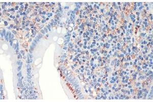 Immunohistochemistry of paraffin-embedded Human appendix using SST Polyclonal Antibody at dilution of 1:200 (40x lens). (Somatostatin antibody)