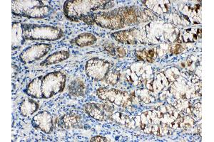 IHC analysis of ALDH1A3 using anti- ALDH1A3 antibody . (ALDH1A3 antibody  (AA 37-154))