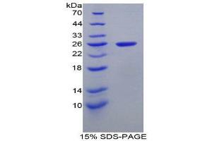 SDS-PAGE (SDS) image for Intercellular Adhesion Molecule 4 (ICAM4) (AA 32-226) protein (His tag) (ABIN2125364)