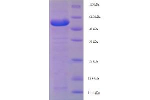 SDS-PAGE (SDS) image for Lysyl Oxidase-Like 1 (LOXL1) (AA 95-607) protein (His tag) (ABIN4978628)