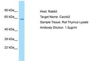 Image no. 1 for anti-Calcium Channel, Voltage-Dependent, beta 2 Subunit (CACNB2) (AA 251-300) antibody (ABIN6749837)