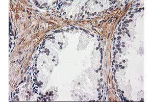 Image no. 1 for anti-Nicotinamide N-Methyltransferase (NNMT) antibody (ABIN1499790) (NNMT antibody)