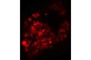 Immunofluorescence of PRICKLE1 in human bladder cells with PRICKLE1 antibody at 20 ug/mL. (PRICKLE1 antibody  (C-Term))