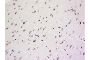 CCDC82 antibody  (AA 301-400)