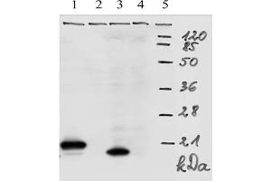 Western-Blot analysis of HPV-18 E7 protein. (HPV18 E7 antibody  (AA 1-35))