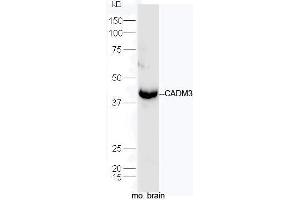 Mouse brain lysates probed with Rabbit Anti-CADM3 Polyclonal Antibody, Unconjugated  at 1:5000 for 90 min at 37˚C.