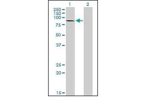 Western Blotting (WB) image for anti-Cadherin 1, Type 1, E-Cadherin (Epithelial) (CDH1) (AA 381-481) antibody (ABIN614587)