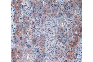 IHC-P analysis of adrenal gland tissue, with DAB staining. (CPT1A antibody  (AA 572-773))