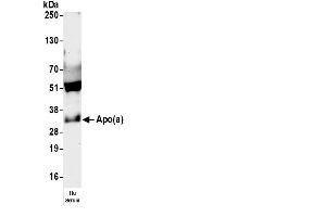 anti-Apolipoprotein A (apo(a)) antibody