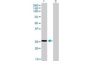 Western Blot analysis of RNF141 expression in transfected 293T cell line by RNF141 monoclonal antibody (M01), clone 6D9.