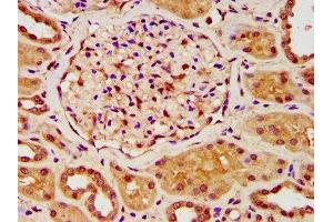 IHC image of ABIN7176620 diluted at 1:200 and staining in paraffin-embedded human kidney tissue performed on a Leica BondTM system. (ZKSCAN5 antibody  (AA 490-643))