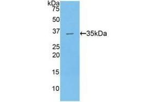 Detection of Recombinant TAFI, Human using Polyclonal Antibody to Carboxypeptidase B2 (CPB2) (CPB2 antibody  (AA 138-386))