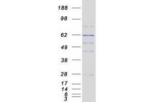 Validation with Western Blot (CCT3 Protein (Transcript Variant 1) (Myc-DYKDDDDK Tag))