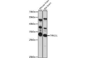 Western blot analysis of extracts of various cell lines, using TPRG1L antibody (ABIN7271100) at 1:1000 dilution. (TPRG1L antibody  (AA 1-90))