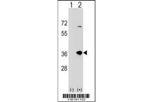Western blot analysis of SULT1B1 using rabbit polyclonal SULT1B1 Antibody using 293 cell lysates (2 ug/lane) either nontransfected (Lane 1) or transiently transfected (Lane 2) with the SULT1B1 gene. (SULT1B1 antibody  (C-Term))