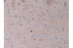 Immunohistochemistry (IHC) image for anti-Carbonic Anhydrase II (CA2) (AA 1-260) antibody (ABIN7438433)