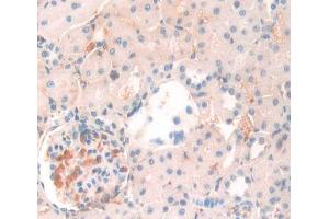 IHC-P analysis of Kidney tissue, with DAB staining. (ANGPTL4 antibody  (AA 228-389))