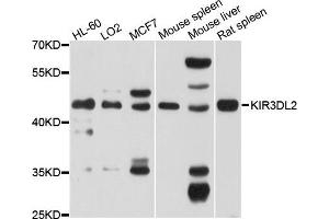 Western blot analysis of extracts of various cells, using KIR3DL2 antibody. (KIR3DL2 antibody)
