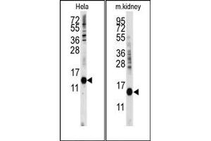 Image no. 1 for anti-Cytidine Deaminase (CDA) (C-Term) antibody (ABIN358052)