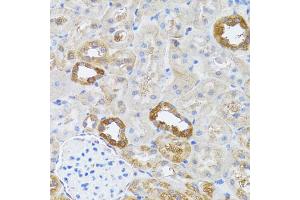 Immunohistochemistry of paraffin-embedded rat kidney using RNASEL antibody. (RNASEL antibody)