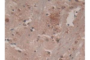 DAB staining on IHC-P; Samples: Rat Brain Tissue