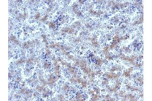 Formalin-fixed, paraffin-embedded human Fetal Liver stained with Glypican-3 Rabbit Polyclonal Antibody. (Glypican 3 antibody)