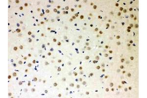 Anti-PKC iota Picoband antibody, (ABIN3043909),IHC(P)IHC(P): Rat Brain Tissue (PKC iota antibody  (AA 21-214))